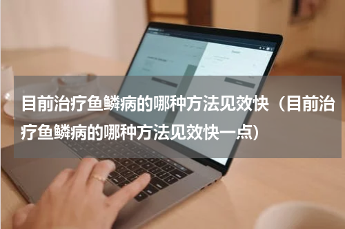 目前治疗鱼鳞病的哪种方法见效快（目前治疗鱼鳞病的哪种方法见效快一点）