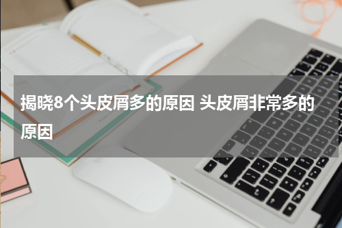 揭晓8个头皮屑多的原因 头皮屑非常多的原因